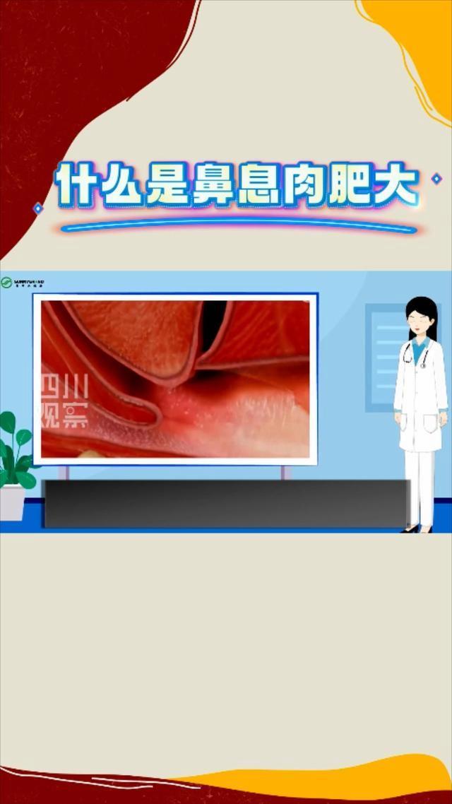 医生解读苟伟鼻息肉肥大 警惕呼吸骤停风险